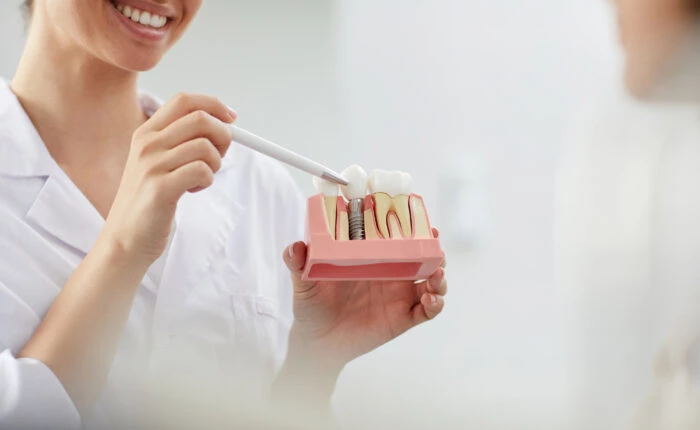 model zębów